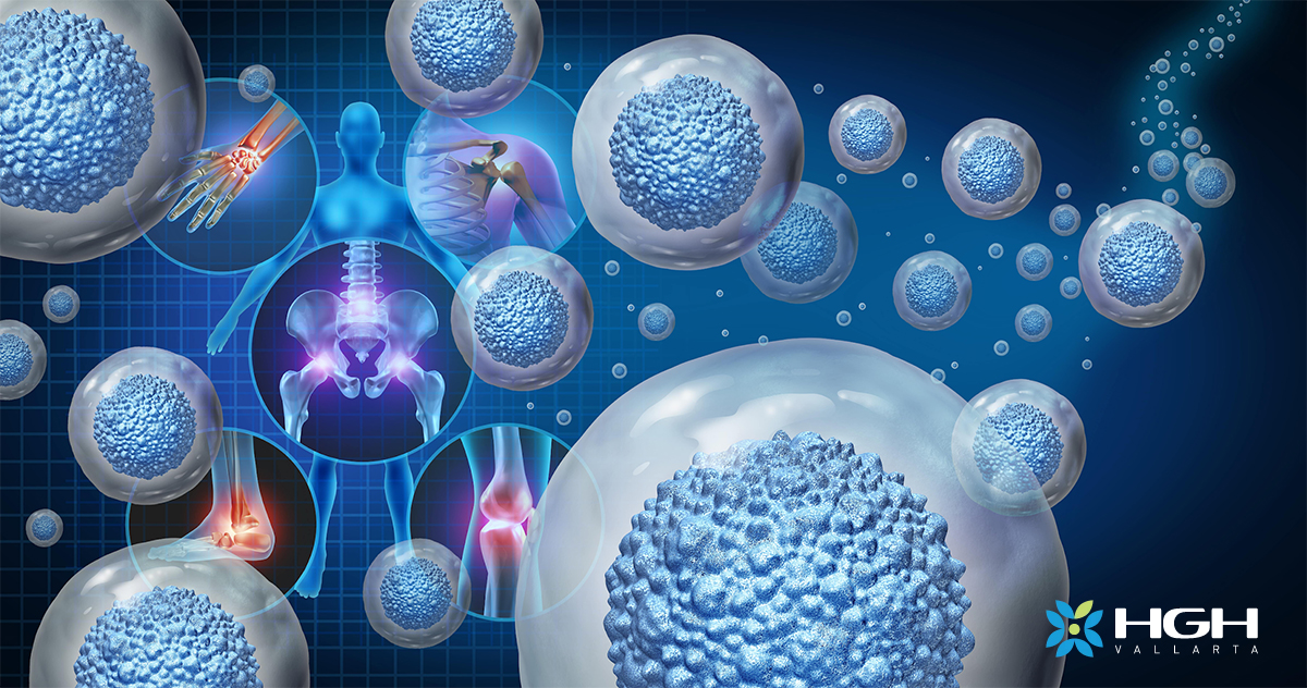 Read more about the article Why You Should Consider Stem Cell Therapy in Mexico